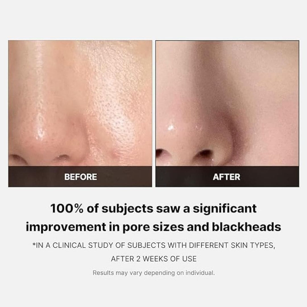 Pads Zero Pore Medicube 2.0 – Texture de Peau & Pores | Ecloria